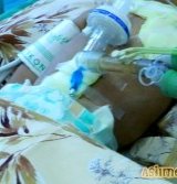 11 ойлик чақалоқнинг танасидан 16 дона игна топилди