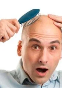 Эркакларнинг сочи нега тўкилиши маълум бўлди