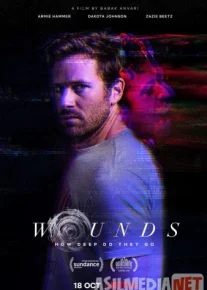 Раны / Wounds Tas-IX