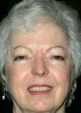 Telma Skunmeyker