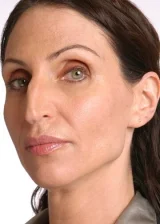 Бонни Ааронс